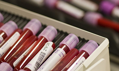 علماء يتوصلون إلى اختبار دم جديد يحدد فرص البقاء على قيد الحياة!