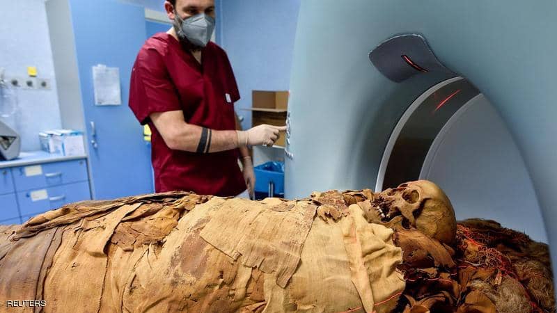 مومياء مصرية في مستشفى إيطالي.. ماذا يفعل بها الباحثون؟ 