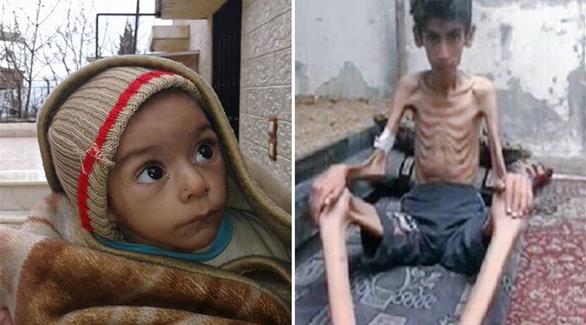 الوضع الإنساني في مضايا والزبداني كارثي