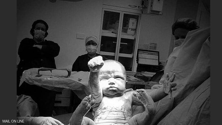 ولادة سوبرمان.. صورة مذهلة لأولى لحظات «الطفل الخارق»