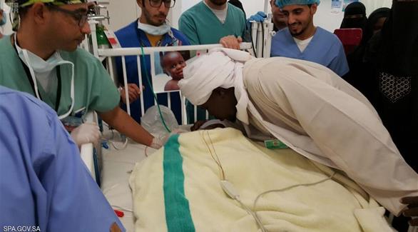 فريق طبي سعودي ينجح في فصل توأم سوداني