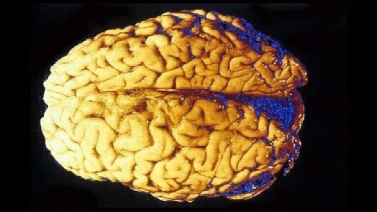 عالم فيروسات بريطاني يكشف خطورة يشكلها كورونا على دماغ الإنسان