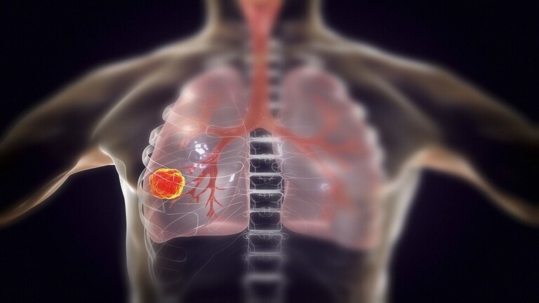تناول «الروب» يومياً يحد من خطر سرطان الرئة